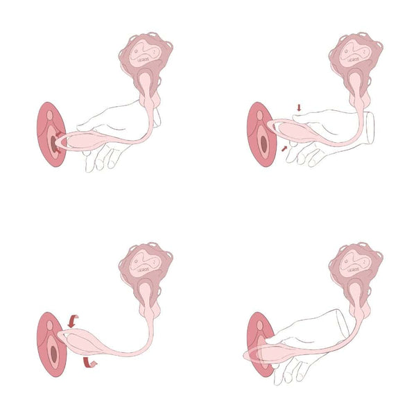 Illustrations explicatives montrant les positions d’utilisation d’un vibromasseur UEROS et les zones de stimulation, vues schématiques sur fond clair.